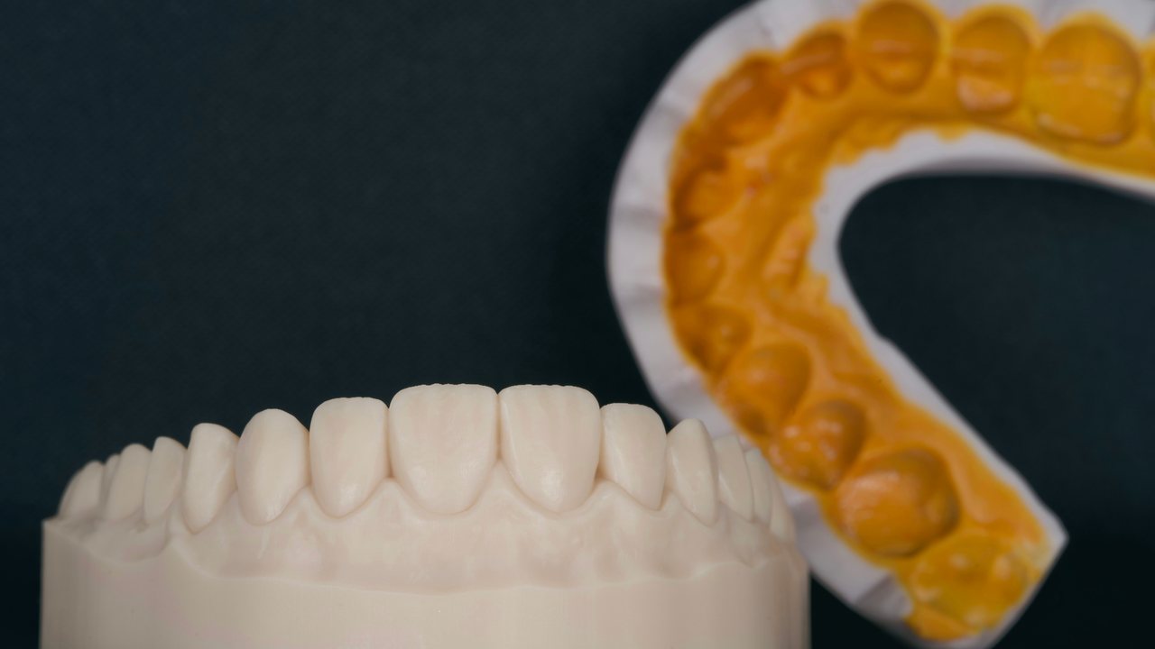 A full-arch wax-up on a model, with an orange silicone index behind it